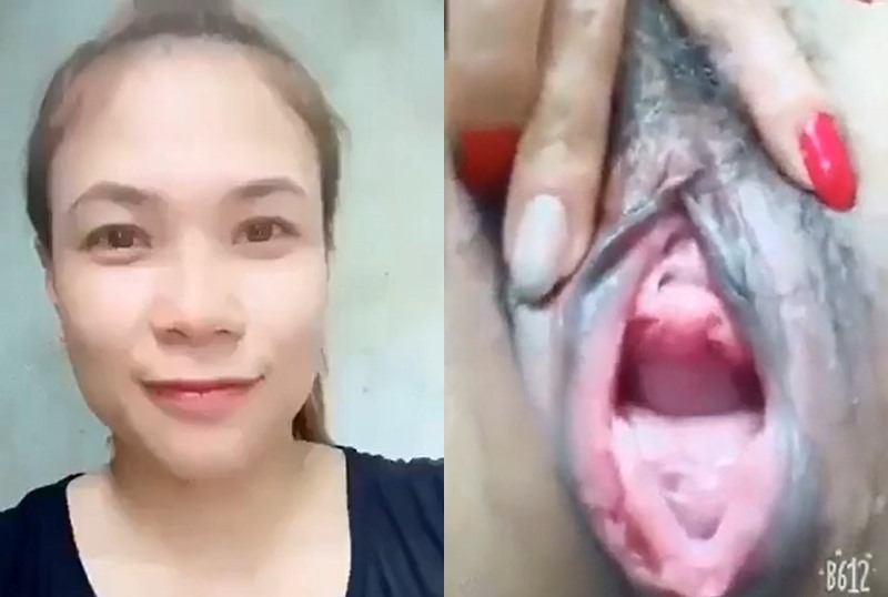 khoe bím thâm đen